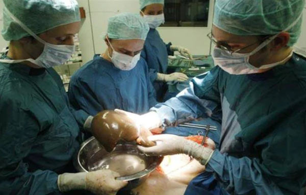 Organ transplant operation